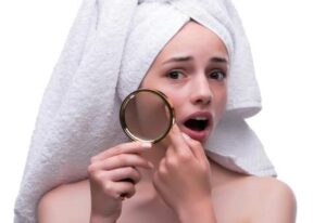 how to control acne great misssenden